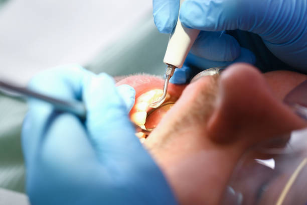 Best Emergency Treatment for Oral Infections in Merchantville, NJ